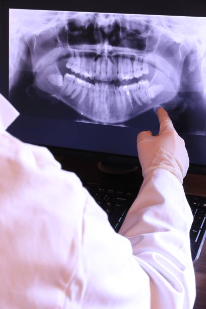 Best Emergency Wisdom Tooth Extraction in Alsip, IL